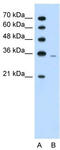 Phosphoribosyl Pyrophosphate Synthetase 2 antibody, TA346094, Origene, Western Blot image 