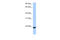 Transmembrane P24 Trafficking Protein 4 antibody, 29-525, ProSci, Enzyme Linked Immunosorbent Assay image 