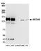 Protein transport protein Sec24B antibody, A304-876A, Bethyl Labs, Western Blot image 