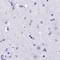 Carboxyl Ester Lipase antibody, NBP2-33663, Novus Biologicals, Immunohistochemistry paraffin image 