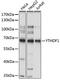 YTH N6-Methyladenosine RNA Binding Protein 1 antibody, 18-301, ProSci, Western Blot image 