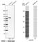 Polypeptide N-acetylgalactosaminyltransferase 6 antibody, NBP1-86100, Novus Biologicals, Western Blot image 