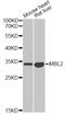 Mannose Binding Lectin 2 antibody, STJ28388, St John