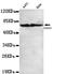 Forkhead Box O1 antibody, TA346948, Origene, Western Blot image 