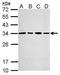 Proteasome activator complex subunit 3 antibody, TA308562, Origene, Western Blot image 