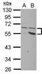 Plexin domain-containing protein 2 antibody, PA5-31215, Invitrogen Antibodies, Western Blot image 