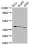 N-Acetylneuraminate Synthase antibody, CSB-PA885699LA01HU, Cusabio, Western Blot image 