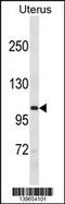 RecQ Like Helicase 5 antibody, 60-547, ProSci, Western Blot image 