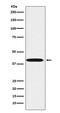 LIM Homeobox 3 antibody, M03803, Boster Biological Technology, Western Blot image 