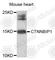 Catenin Beta Interacting Protein 1 antibody, A7122, ABclonal Technology, Western Blot image 