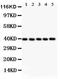C-X-C Motif Chemokine Receptor 6 antibody, PA5-79117, Invitrogen Antibodies, Western Blot image 