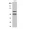 ShcA antibody, LS-C386063, Lifespan Biosciences, Western Blot image 
