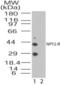 Neuropeptide Y Receptor Y2 antibody, GTX85842, GeneTex, Western Blot image 