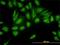 Ubiquitin carboxyl-terminal hydrolase 47 antibody, H00055031-M01, Novus Biologicals, Immunofluorescence image 
