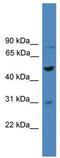 Zinc Finger Protein 577 antibody, TA345452, Origene, Western Blot image 