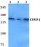 Cytoplasmic FMR1 Interacting Protein 1 antibody, A04596, Boster Biological Technology, Western Blot image 