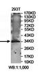 Zinc Finger Protein 75a antibody, orb78474, Biorbyt, Western Blot image 