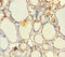 EMAP Like 2 antibody, A56010-100, Epigentek, Immunohistochemistry paraffin image 
