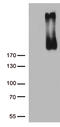 Receptor tyrosine-protein kinase erbB-3 antibody, CF806202, Origene, Western Blot image 
