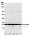 ATP Synthase Peripheral Stalk Subunit D antibody, A305-492A, Bethyl Labs, Western Blot image 
