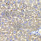 Hydroxysteroid 17-Beta Dehydrogenase 13 antibody, A6256, ABclonal Technology, Immunohistochemistry paraffin image 