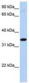 Solute Carrier Family 44 Member 3 antibody, TA333485, Origene, Western Blot image 