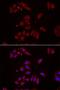 Nephrocystin 1 antibody, LS-C334864, Lifespan Biosciences, Immunofluorescence image 