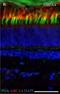 ATP Binding Cassette Subfamily A Member 4 antibody, NBP1-30032, Novus Biologicals, Immunohistochemistry paraffin image 