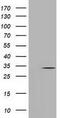 Uridine-cytidine kinase 1 antibody, GTX83442, GeneTex, Western Blot image 