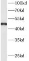Putative disintegrin and metalloproteinase domain-containing protein 5 antibody, FNab00143, FineTest, Western Blot image 