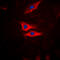 Phospholipase A2 Group IVA antibody, GTX32342, GeneTex, Immunofluorescence image 
