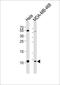 Small Nuclear Ribonucleoprotein Polypeptide G antibody, PA5-49365, Invitrogen Antibodies, Western Blot image 