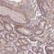 Laminin Subunit Beta 4 antibody, PA5-55025, Invitrogen Antibodies, Immunohistochemistry paraffin image 