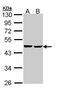 Succinate-CoA Ligase ADP-Forming Beta Subunit antibody, GTX109728, GeneTex, Western Blot image 