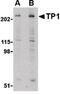 p240 antibody, LS-B597, Lifespan Biosciences, Western Blot image 