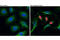 Poly(ADP-Ribose) Polymerase 1 antibody, 6894S, Cell Signaling Technology, Immunocytochemistry image 