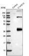 Chromosome 1 Open Reading Frame 210 antibody, NBP1-81061, Novus Biologicals, Western Blot image 