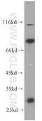 Insulin Like Growth Factor Binding Protein 2 antibody, 15699-1-AP, Proteintech Group, Western Blot image 