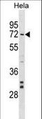 Nuclear Prelamin A Recognition Factor antibody, LS-C158358, Lifespan Biosciences, Western Blot image 