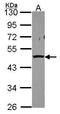 PSMC5 antibody, GTX114676, GeneTex, Western Blot image 