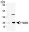 PDS antibody, GTX30911, GeneTex, Western Blot image 