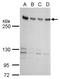 Zinc finger protein 638 antibody, GTX120667, GeneTex, Western Blot image 