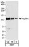 Poly(ADP-Ribose) Polymerase 1 antibody, A301-376A, Bethyl Labs, Western Blot image 