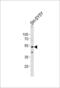 Dynactin Subunit 2 antibody, 56-720, ProSci, Western Blot image 