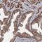 Centrosomal Protein 76 antibody, NBP1-88472, Novus Biologicals, Immunohistochemistry paraffin image 