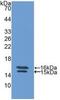 Vasoactive Intestinal Peptide antibody, MBS2004544, MyBioSource, Western Blot image 