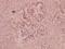 PLAU antibody, A04352, Boster Biological Technology, Immunohistochemistry paraffin image 