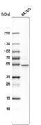 Cysteine Rich Secretory Protein LCCL Domain Containing 2 antibody, NBP1-85143, Novus Biologicals, Western Blot image 