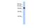 Armadillo Repeat Containing 3 antibody, GTX45240, GeneTex, Western Blot image 