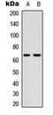 Cell Division Cycle 25B antibody, orb304715, Biorbyt, Western Blot image 